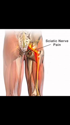Warning: your wallet might be wrecking your back! Fat wallet syndrome is real! ditch the bulky wallet in your back pocket and switch to a slim one or carry it in front to avoid hip and back pain! #fypシ゚viralシfypシ゚viralシalシ #2025goals #health #healthylifestyle The Health GOAT Healthy Gym Baddies 🏋🏽‍♀️🥗🍋🍉 Health and Wellness | Mindful Living