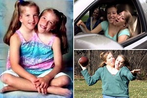 World's most famous conjoined twins, 29, learn to drive and go to uni despite fears they would not survive