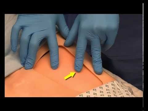 Anatomical Fascia Iliaca Compartment Block (FICB) Teaching Video
