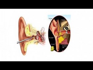 Hearing Problems: What You Need to Know