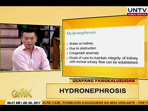 Hydronephrosis: Swollen Kidney | Usapang Pangkalusugan