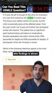 USMLE: Don't Get This Super High Yield Question Wrong on Step 1,2 & 3 #shorts #usmle #doctor