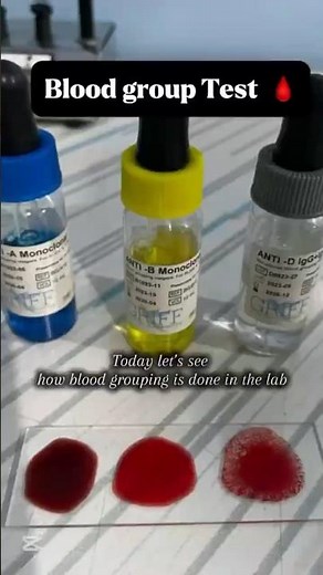 Blood Group Test (ABO + Rh) 🩸