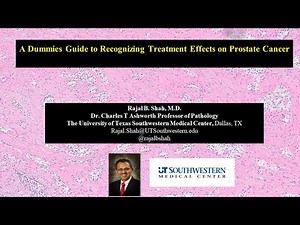 A Dummies Guide to Recognizing Treatment Effects in Prostate Cancer