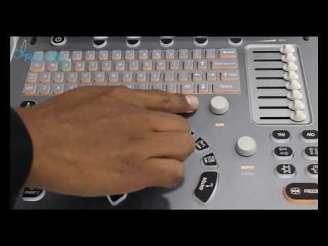 Ultrasonido ECO5 CHISON