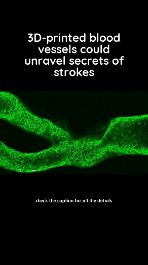 3.1K views · 16 reactions | 3D-printed, anatomically accurate blood...