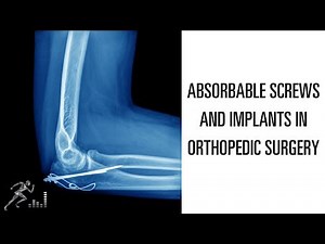Absorbable screws and implants in orthopedic surgery