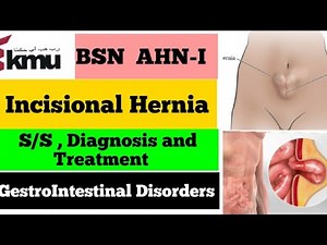 Incisional Hernia | Hernia and Its Types | Gastrointestinal Disorder | AHN BSN | Nursing With Farman