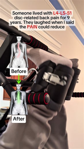 Send this to someone with lower back pain #decompression #backpain