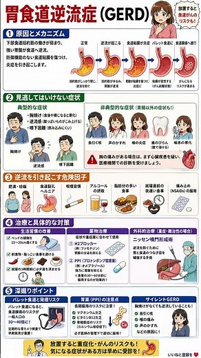 【放置厳禁】その胸やけ、食道がんのリスクかも？胃食道逆流症（GERD）の正体と、絶対に見逃してはいけない意外な初期サインを徹底解説！