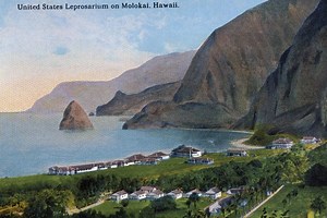 Tragična istorija obolelih od lepre: Odvođeni su u kolonije gde ih je čekao doživotni karantin