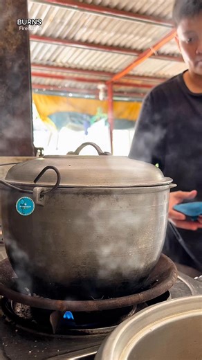 🔥 First Aid for Scald Burns: What to Do Immediately When seconds count, knowing what to do can prevent further damage. 🔄 Emergency Steps: 1️⃣ Stop the source – Immediately remove the victim from the hot liquid. 2️⃣ Cool the burn – Use running water (12–25°C) for at least 20 minutes. 3️⃣ Remove jewelry/accessories – To prevent constriction as swelling occurs. 4️⃣ Cover the burn – Apply a sterile, non-stick dressing. 5️⃣ Monitor for hypothermia – Especially in children or large burn areas. ⚠️ Wh