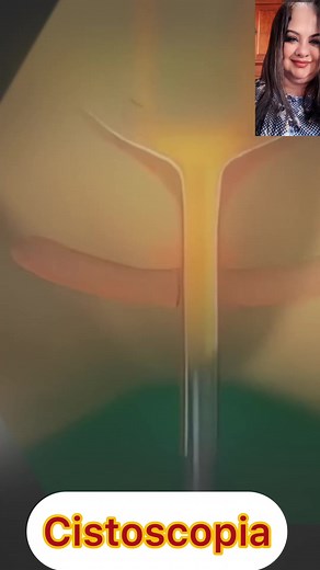 Como é feito o exame de cistoscopia: procedimento e objetivos