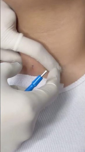Dermal Piercing Process #dermalpiercing #flatpiercing #piercing