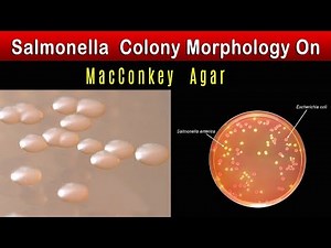 Salmonella Colony Morphology On MacConkey agar