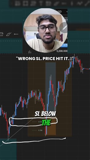I Placed My Stop Loss in the Wrong Place — Price Hit It Immediately 😤
