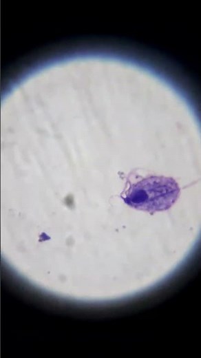 trophozoite of Trichomonas vaginalis #microscope #biology #science #parasite