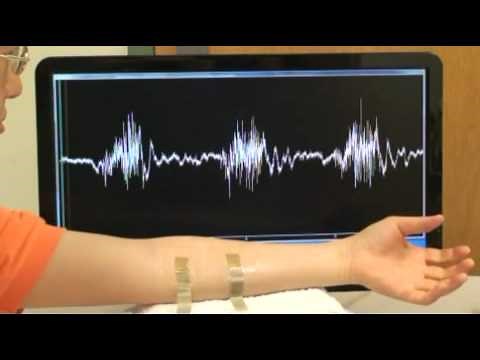 EMG waveforms recorded from left forearm