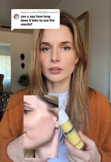 Effective Remedy for Dark Spots: Your Skincare Solution