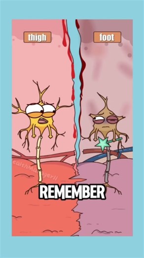 healthmanager11 on Instagram: "Why does the 'non-existent limb still hurt after amputation? #animation #funny #shorts #webtoon #trendingreels"