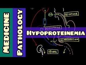 Hypoproteinemia - causes and diagnosis | Pathology, Medicine |