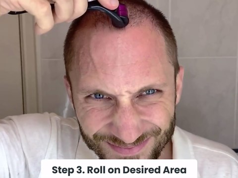 ROSELYNBOUTIQUE Derma Roller for Hair Beard Facial Skin Face Body Scalp 540 Titanium Microneedle for Men Women 0.25mm Cosmetic Beauty Instrument