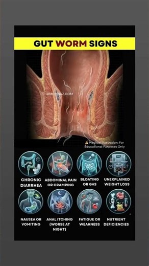 Signs of Parasitic Infestation#parasite #medical #nursing #medicalknowledge #medicalstudent #gnm