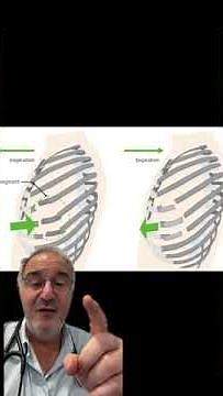 Des fractures multiples de cotes responsables d'un volet costal #fracture #côtes #reanimation