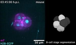 Live imaging and segmentation of a mouse embryo (VIDEO)