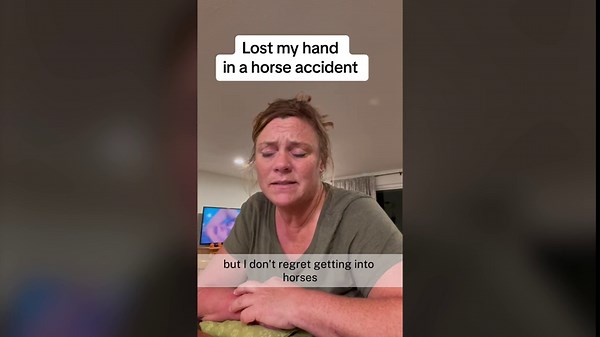 ‘My Hand Was Missing’—Mom Recalls Freak Horse Accident