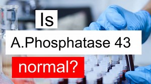 Treatment and symptoms of Alkaline phosphatase 43 U/L | Diet for normal ALP level 43 U/L