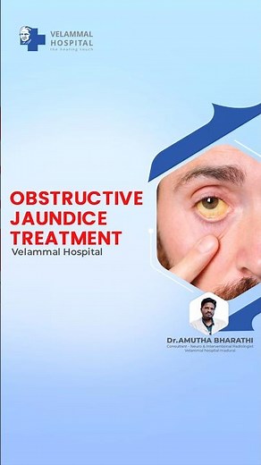 Doctor Talks | Obstructive Jaundice Explained | Velammal Hospital | Madurai