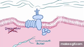Duchenne & Becker muscular dystrophy - causes, symptoms, treatment & pathology on Make a GIF