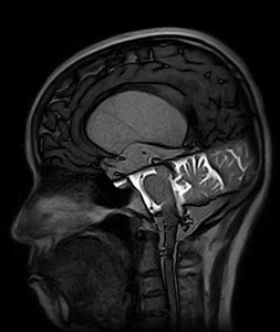 8.4K views · 183 reactions | Time-spatial labeling inversion pulse...
