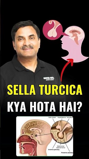 Do you know about Sella Turcica? #neetbiology #neet2024 #biology