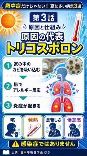 夏だけ続く咳に注意！カビが原因の「夏型過敏性肺炎」【医師解説】