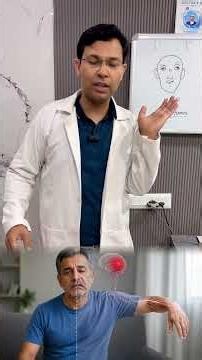 Is Facial Paralysis Normal or Dangerous? Learn from Neurosurgeon Dr. Ashwani Kumar #trending #vir...