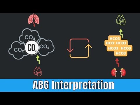 CO2 Retention (PaCO2): ABG analysis
