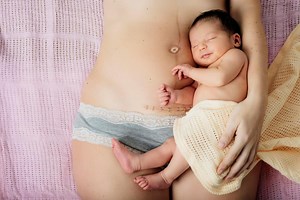 Here's how Caesareans work and when you might need an emergency op
