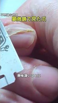 顕微鏡で見た爪