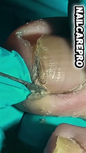 Nail Cutting & Cleaning at Home | Perfect Clean Trim! #nails #cleaning