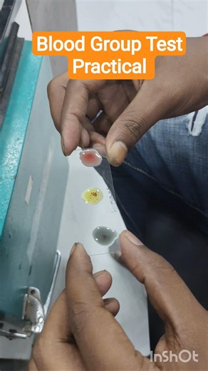 Blood Group Test Practical #lablife #labtechnician #dmlt