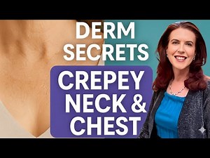 How to FIX a Crepey Neck and Chest-What REALLY Works!