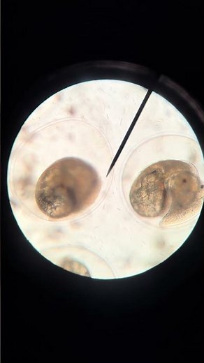 Likely some Left-Handed Lunged Snail eggs found by 7th Grade Students using a light microscope