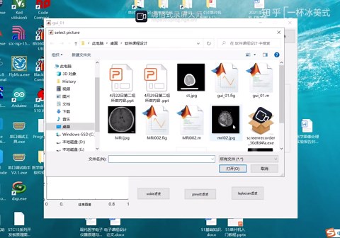 脑部MRI图像预处理系统