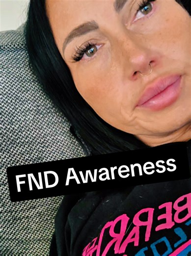 Functional Neurological Disorder (FND) isn’t very common, but it’s very real. One of my most common symptoms is seizures. Just because you can’t always see a disability doesn’t mean it isn’t there. FND can absolutely be a handicap & awareness matters. #fndawareness #fnd #functionalneurologicaldisorderawareness #seizures #fyp
