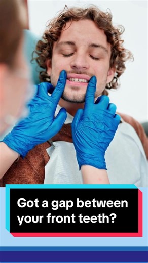 Gap between your front teeth? 👀 Here are 3 ways to fix it (yep, even invisible ones 👻) Which one would you try?👇 Talk to us! 门牙有缝？👀 3种常见处理方式分享给你～👇 #牙缝处理 #隐形牙套 #笑容升级 #墨尔本牙医 #瓷贴片 #mcdental #ToothGapFix #Invisalign #SmileGlowUp #MelbourneDentist #porcelainveneers #veneers