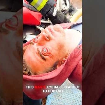 His Friends Literally Popped His Eyeball Out #movie #film