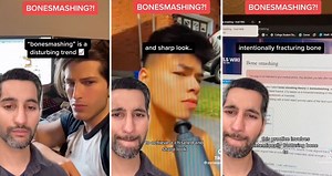 The latest dangerous viral TikTok trend is supposedly convincing people — mostly young men — to break their bones to achieve a chiseled jawline. | New York Post