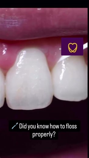 This is how to floss teeth! #flossing #oralcare #dailyoralhabits #flosser #dentalclinicinbarnala